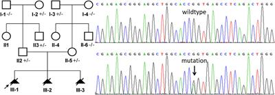 Case Report: Identification Pathogenic Abnormal Splicing of BBS1 Causing Bardet–Biedl Syndrome Type I (BBS1) due to Missense Mutation